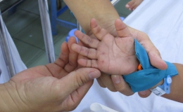 Hơn 42.700 ca tay chân miệng, Bộ Y tế hướng dẫn người dân đối phó