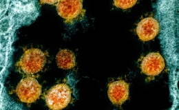 Vì sao biến chủng của virus SARS-CoV-2 xuất hiện ngày càng nhiều và nguy hiểm hơn?