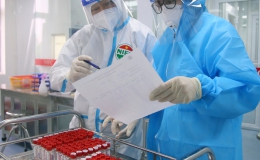Bộ Y tế yêu cầu báo cáo giá bán test xét nghiệm SARS-CoV-2