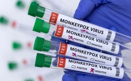 Có nên tiêm vaccine đậu mùa khỉ sau khi Việt Nam đã có ca mắc?